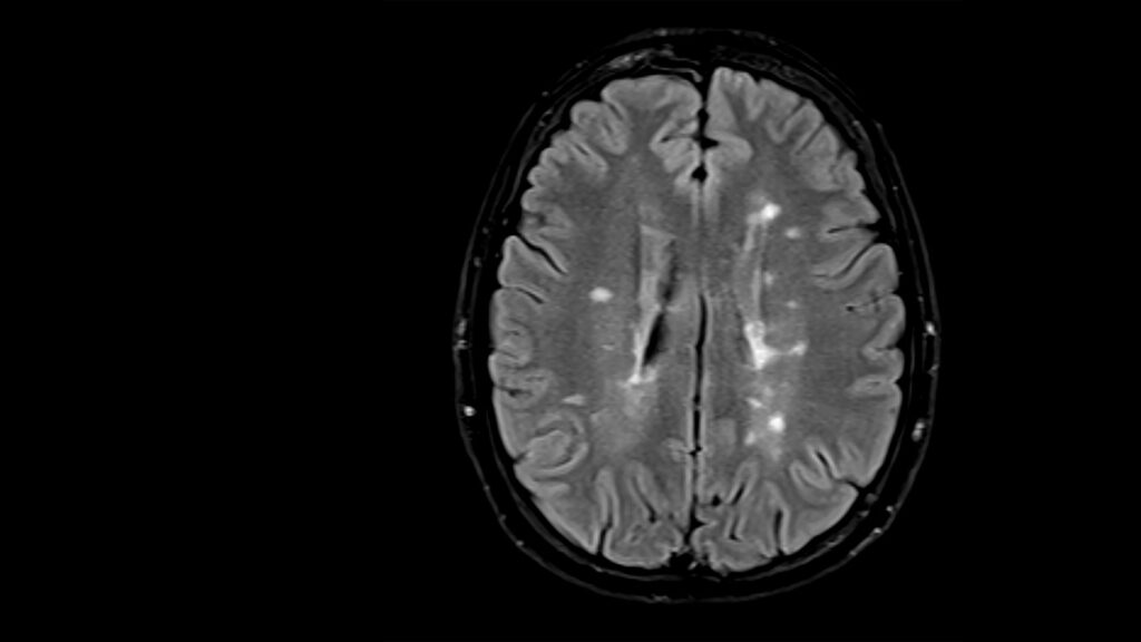 Machine Learning Image Reconstruction: image of a brain scan